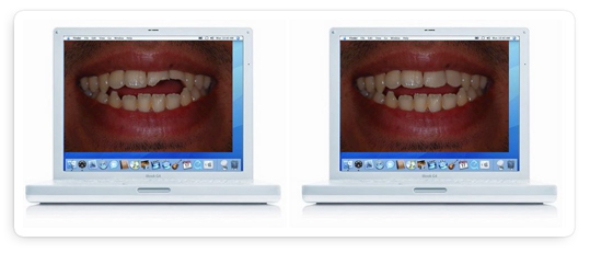 estetica dentales analisis por computadora